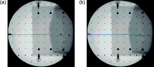 Figure 8. a) Needle and tissue image. b) Detected needle and planned insertion path. [Color version available online.]