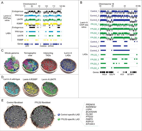Figure 2. 3D genome modeling provides a spatial appreciation of LADs altered by lamin A mutations causing laminopathies. (A) Genome browser view of lamin A ChIP-seq profiles and LADs in a region of chromosome 2 in HeLa cells expressing indicated lamins. (B) Lamin A ChIP-seq profiles and LADs in a region of chromosome 18, in three control and four FPLD2 patient fibroblast cultures, the latter all with the R482W mutation. LAD data in (A) and (B) are from reference [Citation26]. (C) A 3D structural model of HeLa cell nuclei. The whole-genome model reflects chromosome territories; each chromosome is modeled as a chain of beads representing TADs, and is colored differently. Chromosome territories are also visible in the tomographic view. Tomographic views of the same genome structure also reveal TADs interacting pairwise (red) and TADs containing LADs (blue) (adapted from reference [26). (D) 3D genome models showing LADs generated by expression of indicated lamins in HeLa cells [Citation26]. (E) 3D genome models showing LADs specific to control and FPLD2 fibroblasts with the lamin A R482W mutation (from reference [26). Box, genes pertaining to white and brown adipogenesis found in FLPD2-specific LADs. Nucleus radius in the models in (C-E) is 5 µm. All panels were from reference [Citation26] and were used with permission.