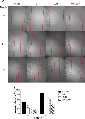 Figure 2 Effect of ulinastatin (UTI) and curcumin (CUR) on cell migration and invasion. (A) Migration of HCT-116 was assayed by wound healing assay. Cells were cultured to nearly confluent cell monolayer. A scratch wound was created on the cell surface using a micropipette tip. The monolayer was washed with phosphate buffered saline, and then UTI (800 U) or CUR (10 μM) was added or not. The cultures were incubated at 37°C for 0 hours, 24 hours, and 48 hours, respectively, and pictures were taken using light microscopy (×100). (B) The width of the wound was measured and the wound closure rate was calculated. (C) Transwell in vitro invasion assay detects the effect of UTI and CUR on the invasive ability of colon cancer cells. (a) cells treated with PBS; (b) cells treated with UTI; (c) cells treated with CUR; (d) cells treated with UTI and CUR. (D) The invaded cell numbers were measured and compared.
