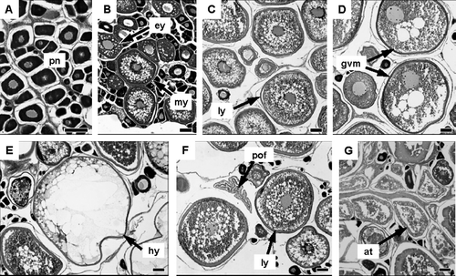 Fig. 4  Photomicrographs of ovaries at different developmental stages in Seriola lalandi: (A) immature stage; (B) developing stage; (C) vitellogenic stage; (D-E) mature stage; (F) spawning stage; (G) resting stage. at, atretic oocyte; ey, early yolk oocyte; gvm, germinal vesicle migration oocyte; hy, hydration oocyte; ly, late yolk oocyte; my, mid-yolk oocyte; pn, perinucleolus oocyte; pof, postovulatory follicle. Scale bar equals 100 µm.