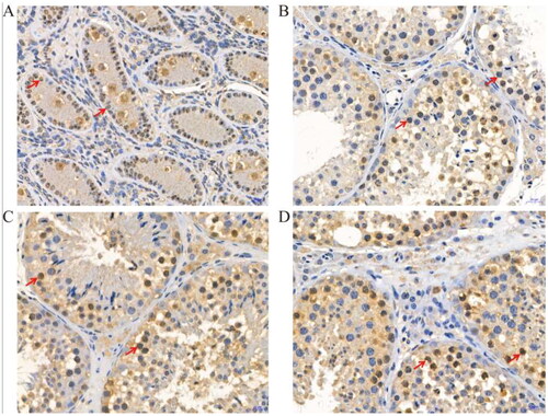 Figure 5. Immunohistochemical staining of PCNA protein at different developmental stages of yak testes (400×); (A) 6 months of Ashidan yak; (B) 18 months of Ashidan yak; (C) 30 months of Ashidan yak; (D) 72 months of Ashidan yak.