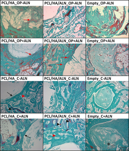 Figure 8 Details of the partially healed defect area in different groups visualized in Masson’s green trichrome-stained histological sections. The formation of new bone is apparent in the margins of the defects in all groups from woven bone of different thickness (black arrow) to the trabecular bone formation expanding from the margin of the defect to its center. The original matured bone (black arrowhead) is colored reddish in contrast to less mineralized new formed bone areas (red arrowhead). In the distinct groups, reddish areas of mineralized matrix (red arrow) were also apparent in the newly formed highly dense areas of woven bone in the margins of the bone defects or directly in the defect area. In the groups with empty defects without scaffold presence, the defect area was almost filled with new bone with remnants of the defect filled with connective tissue rich in blood vessels (asterisk).