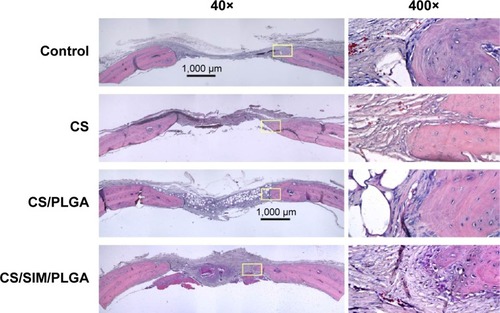 Figure 4 Histological specimens from calvarial defects 10 weeks after implantation of bone graft substitutes with hematoxylin-eosin staining.Note: Calvarial defects implanted without bone graft substitutes were used as controls.Abbreviations: CS, calcium sulfate; SIM, simvastatin; PLGA, poly(lactic-co-glycolic acid) microspheres.