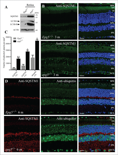 Figure 2. Accumulation of LC3-II, SQSTM1 aggregates and ubiquitin-positive inclusions in the retinas of epg5 knockout mice. (A) Immunoblot of LC3 and SQSTM1 in retinal extracts from epg5−/− and Epg5+/− mice aged 6 mo. (B) SQSTM1 aggregates dramatically accumulate in the GCL, OPL and INL of 3-mo-old epg5−/− mice, but not littermate controls. (C) Quantification of the number of cytoplasmic SQSTM1 and ubiquitin-positive aggregates in the retinas of epg5−/− and Epg5+/− mice aged 3 and 6 mo. Means ± SEM of 4 mice are shown. *P < 0.05, **P < 0.01. Statistical comparisons were performed with 2-tailed, unpaired Student t tests. (D) SQSTM1 aggregates and ubiquitin-positive inclusions dramatically accumulate and are colocalized in Epg5+/− retinas aged 6 mo. Scale bars in ((B)and D): 20 µm.