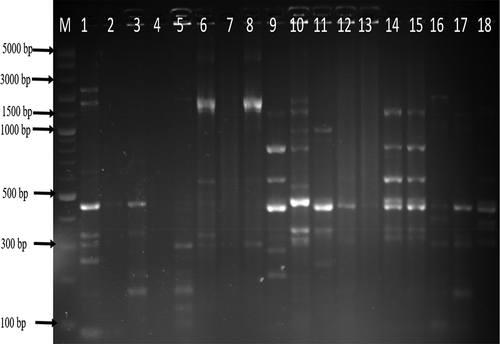Figure 2. Gel ERIC-PCR amplification results of C. jejuni isolates. M, DNA ladder, 1–18: some amplified C. jejuni isolates.