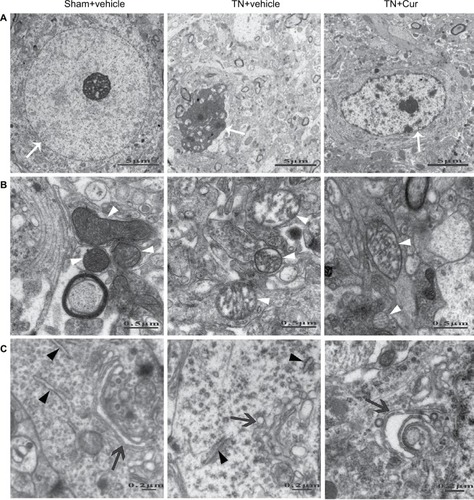 Figure 6 Representative photomicrographs showing the ultrastructures of neurons in the hippocampal CA1 region.