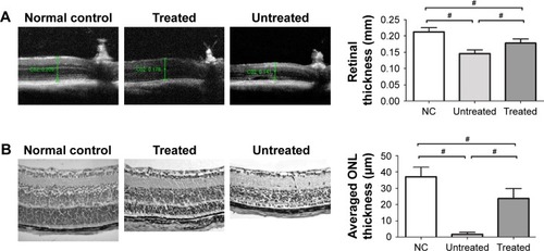 Figure 3 (A) Experimental animals were subjected to SD-OCT examination and their retinal thicknesses were quantified in vivo. Retinal thickness of the treated eyes was significantly smaller than that of normal controls. However, the retinal thickness of the treated eyes was significantly larger than that of untreated eyes. (B) The ONL of the untreated eyes disappeared after MNU administration. Conversely, a large proportion of ONL was retained in the retinas of treated eyes. The average ONL thickness of the treated eyes was significantly smaller than that of normal controls. The average ONL thickness of the treated eyes was significantly larger than that of the untreated eyes. All values are presented as mean ± SD; #P<0.01 for differences compared between eye groups.