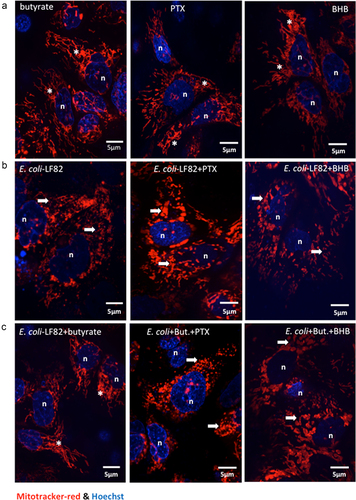 Figure 7. Pertussis toxin and β-hydroxybutyrate (BHB) implicate FFAR3 in butyrate’s maintenance of epithelial mitochondrial networks. Monolayers of the human colon-derived T84 epithelial cell line (106) were treated with E. coli-LF82 (108 cfu, 4 h) ± a co-treatment with sodium butyrate (But., 10 mM) ± an 18 h pre-treatment with pertussis toxin (PTX, 50 ng/ml) or BHB (5 mM). (a) Representative images were collected in a random fashion by first identifying epithelia nuclei (blue, n) and then swapping the confocal laser channel to assess the mitochondrial network (Mitotracker (red)). Twenty cells per monolayer were characterized for mitochondrial fragmentation count by ImageJ analysis and averaged/monolayer (b). (c) Mitochondrial membrane potential was assessed by TMRE fluorescence in a flow cytometer. A 10 min treatment with the metabolic toxin, FCCP (10 Ohms.cm2) was used as a positive control. The effect of the FFAR2 antagonist (S)-3-(2-(3-chlorophenyl) acetamido)-4-(4-(trifluoromethyl) phenyl) butanoic acid (CATPB, 10 Ohms.cm2, 30 min pre-treatment) is also shown (mean ± SEM; n = 5–6 epithelial monolayers from separate experiments in panels a and b; * and #, p <.05 compared to control uninfected cells and E. coli-LF82 only infected cells respectively by two-way ANOVA followed by Tukey’s multiple comparison test (b) or the Kruskal–Wallis test from by Dunn’s multiple comparison test; image *, fused mitochondrial network with elongated strands; arrow, fragmented, vesiculated area of the mitochondrial network; MFI, mean fluorescence intensity).