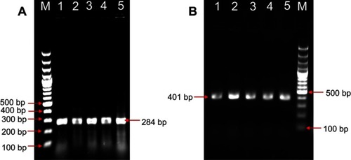 Figure 2 PCR detection of Salmonella Typhimurium from field samples. (A) Genus-specific invA PCR for Salmonella produced an amplicon of 284 bp, (B) Typhimurium-specific PCR produced an amplicon of 401 bp. Lane M: 100 bp molecular weight marker; Lane 1–4: Salmonella Typhimurium isolates from field samples, Lane 5: Positive control.