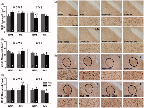 Figure 2. Early life and adult stress with/without amitriptyline on GR and MR in amygdala LEFT. Mean number per unit area (0.1 mm2) of (A) glucocorticoid receptor-immunoreactive (GR-IR) neurons in the medial amygdaloid nucleus; (B,C) mineralocorticoid receptor-immunoreactive (MR-IR) neurons in (B) the central, and (C) medial amygdaloid nuclei of non-maternally separated (NMS) and maternally separated (MS) rats submitted to chronic variable stress (CVS) or not (NCVS) under amitriptyline (10 mg/kg; AMI) or vehicle (Vehic) treatment. Data were analyzed by a linear mixed effect model followed by LSD post hoc test. Data are mean + SEM. Number of rats per group is included inside each bar. Significant differences: a, p < 0.05 versus respective Vehic; b, p < 0.05 versus respective unstressed; c, p < 0.05 versus respective NMS. RIGHT. Representative photomicrographs. (D) GR-IR neurons in the medial amygdaloid nucleus of the NMS and MS NCVS (Rows 1 and 2) and CVS rats under AMI or Vehic treatment. Significant differences shown in graph A are indicated (a,b). (E) MR-IR neurons in the central amygdaloid nucleus of NMS (left 2 columns), MS, NCVS (upper 2 rows) and CVS rats under AMI or Vehic treatment. Significant differences shown in graph B are indicated (a,b,c).