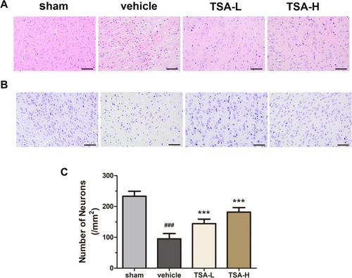 Figure 4 TSA alleviated neuronal damage. (A) The results of HE staining in different groups. (B) The results of Nissl staining in different groups. (C) The changes in the number of intact neurons in different groups. Scale bar= 100μm. ###P< 0.001 vs the sham group; ***P< 0.001 vs the vehicle group.