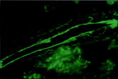 5 Micrograph of kidney sample 6 h after feeding a single dose of PCEFB/PLGA microspheres.