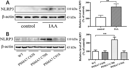 Figure 5. PSMA7 S-sulfhydration modulates NLRP3 expression in adrenocortical cells. (A) Y1 cells were treated with IAA (2 mM) or vehicle for 24 h and then harvested for the determination of NLRP3 protein expression. Left panel: The representative image of NLRP3. Right panel: Statistical graph. (B) Y1 cells were transfected with WT and various mutants of PSMA7. Left panel: The representative image of NLRP3. Right panel: Statistical graph. The cells were then harvested for the determination of NLRP3 protein expression. Data were expressed as mean ± SEM. n = 4 independent cultures. **P < 0.01.