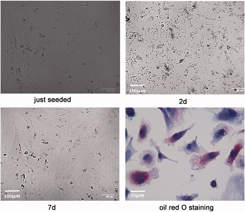 Figure 1. Isolation and identification of primary rat adipocytes. The morphology of the isolated primary rat adipocytes at 0 day (just seeded), 2 days (2d) and 7 days (7d) and after oil red O staining was showed.