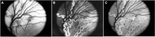 Figure 5 Intravitreal neovascularization in the dog OIR model.