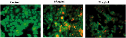 Figure 7. Induction of apoptosis on HCT-116 cells studied using AO/EB staining assay.