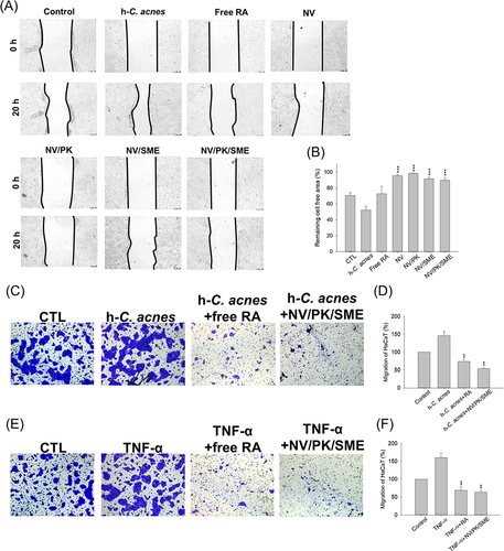 Figure 4 The effect of liposomes on the proliferation and migration regulation of human keratinocytes: (A) the migration of h-C. acnes-stimulated keratinocytes after liposome treatment as determined by in vitro scratch assay; (B) the measurement of remaining cell free area based on the in vitro scratch assay; and (C) the migration of h-C. acnes-stimulated keratinocytes after liposome treatment as determined by in vitro transwell assay; (D) the measurement of crystal violet-stained h-C. acnes-stimulated keratinocytes in the bottom layer based on the in vitro transwell assay; (E) the migration of TNF-α-stimulated keratinocytes after liposome treatment as determined by in vitro transwell assay; and (F) the measurement of crystal violet-stained TNF-α-stimulated keratinocytes in the bottom layer based on the in vitro transwell assay. All data are presented as the mean of three experiments±S.E.M. ***p < 0.001 or **p < 0.01 as compared to the stimulator treatment group without liposome intervention.