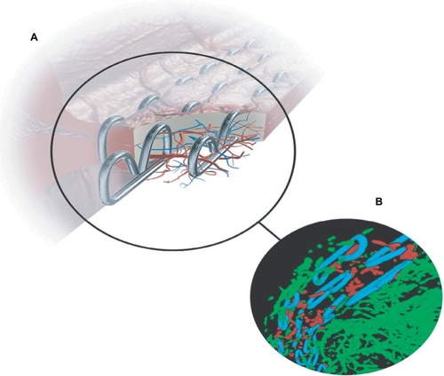 Figure 1 Tissue mock-up with staples and actual perfusion sampling.