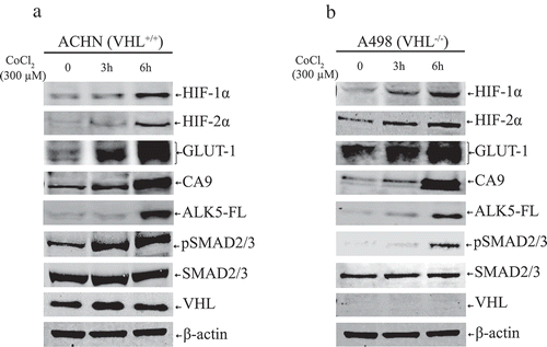 Figure 3. (a) Immunoblots show protein expression of HIF-1α, HIF-2α, GLUT-1, CA9, ALK5-full length (ALK5-FL), pSMAD2/3, SMAD2/3, and VHL after treatment with CoCl2 (300 µM) at indicated time points in ACHN cells (n = 3 independent experiments). All protein bands in each lane originated from the same cell lysate. β-actin served as an internal loading control. (b) Immunoblots show protein expression of HIF-1α, HIF-2α, GLUT-1, CA9, ALK5-full length (ALK5-FL), pSMAD2/3, and SMAD2/3, and VHL after treatment with CoCl2 (300 µM) at indicated time points in A498 cells (n = 3 independent experiments). All protein bands in each lane originated from the same cell lysate. β-actin served as an internal loading control.