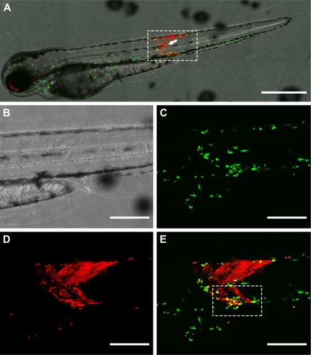 Figure 4 Distribution of zebrafish macrophages and gelatin nanospheres in the muscle tissue surrounding the injection site at 3 hours after intramuscular injection of gelatin nanospheres into a 3-day-old zebrafish larva. (A) Merged overview image with white dashed box indicating the tissue area of injection (injection site indicated by arrow). (B–E) Magnification of the boxed area of (A); (B) depicting the bright field image; (C) green fluorescent macrophages; (D) red fluorescent gelatin nanospheres; (E) merged image of (C) and (D) with co-localization of gelatin nanospheres and macrophages depicted in yellow. Several macrophages co-localized with gelatin nanospheres (E, white dashed box). Scale bar in (A) represents 500 μm and in (B–E) 200 μm.