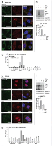 Figure 1. The n-3 PUFA DHA induces SQSTM1/p62-bodies in macrophages. (A) Confocal analysis of RAW264.7 cells treated with DHA, OA or AA (70 µM) for 8 h (scale bars: 10 µm) and (B) automated quantification of SQSTM1- and Ub-positive speckles (< 7000 cells/condition). Data are representative of 3 independent experiments of which 2 were manually counted. (C) Immunoblot (IB) analysis and quantification (below) of RAW264.7 cells treated with DHA, OA and AA (70 µM) for 16 h, n = 4, (repeated measures ANOVA with Dunnett's). (D) Confocal analysis of MDMs treated with DHA, OA or AA (70 µM) for 24 h (scale bars: 10 µm) and (E) automated quantification of SQSTM1/p62-bodies (< 4000 cells/condition), n = 3 except for 48 h where n = 1. (F) IB and quantification (below) of MDMs treated with DHA, OA and AA (70 µM) for 16 h, n = 5, (Friedman test with Dunn's).