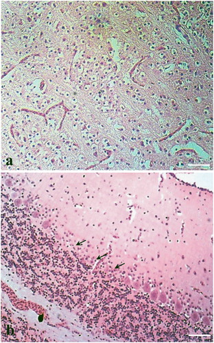 Figure 2. Histopathological changes in brain from avian influenza infected ducks (H&E stain). Section of brain showing (a) gliosis (bar = 50 µm) and (b) loss of Purkinje cells (arrows) (bar = 25 µm).