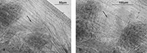 Figure 7 Cognettia valeriae n. sp. Details of spermatheca (marked by arrows): a, spherical enlargement of ampulla; b, final globular chamber.