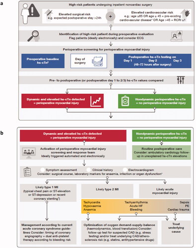 Figure 2. Example of a potential perioperative cTn screening and management pathway.Footnote: Algorithm published in European Journal of Anaesthesia by Puelacher et al. [Citation20]. (a) Details the perioperative screening pathway, including how to define high risk patients. (b) Depicts a perioperative management and care pathway.*Known significant cardiovascular disease, such as coronary artery disease, cerebral vascular disease, peripheral arterial disease, congestive heart failure.†Preoperative cTn may provide information for risk stratification, but it is mainly necessary as a baseline value for perioperative myocardial injury screening.cTn: cardiac troponin; ECG: electrocardiogram; hs: high-sensitivity; RCRI: Revised Cardiac Risk Index