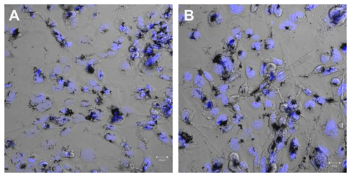 Figure S7 Images of cells exposed to vapor grown carbon fiber (VGCF®) at the approximate concentration of IC50 for 24 hours. (A) BEAS-2B cells exposed to 5 μg/mL of VGCF and (B) MESO-1 cells exposed to 10 μg/mL of VGCF.