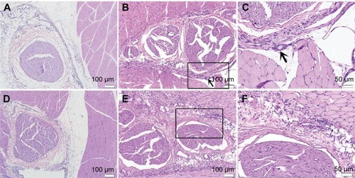 Figure 4 Sciatic nerves and surrounding tissues were stained with hematoxylin and eosin at 7 d after administration.Notes: (A) Image of rats in control group, no inflammation cell was observed (×100). (B) Image of rats treated with PELA, some inflammation cells were observed (×100). (C) High-magnification images of (B), arrows to the inflammation cells and microparticles (×200). (D) Image of rats in Rop group, slight inflammation was observed near the sciatic nerve (×100). (E) Image of rats in Rop-PELA group, granulation tissue and moderate degree inflammation were detected at the site of administration (×100). (F) High-magnification images of (E) (×200). Sciatic nerves in all groups were almost normal.Abbreviations: Rop, ropivacaine; PELA, poly ethylene glycol-co-poly lactic acid; d, day.