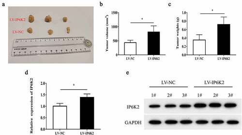 Figure 3. Overexpression of IP6K2 promoted the growth of glioma in vivo A Representative images of tumors in nude mice in each group; B Determine tumor volume; C Determine tumor weight; D RT-PCR showed that the expression of IP6K2 was increased in the tumor tissues of the LV-IP6K2 group; E Western blot showed that IP6K2 was expressed in the LV-IP6K2 group Increased in the tumor tissue. *p < 0.05.