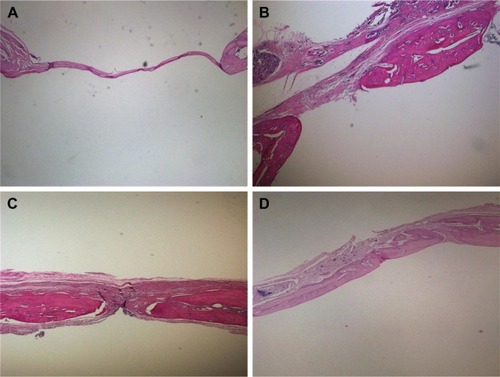 Figure 10 H&E staining of SD rat cranial defects at different time points.Notes: (A) Control group and (B) 50 mg ACS-CCM at 4 weeks. (C) Control group and (D) 50 mg ACS-CCM group at 8 weeks.Abbreviations: H&E, hematoxylin and eosin; SD, Sprague-Dawley; ACS-CCM, aspirin-loaded chitosan nanoparticles contained in collagen-chitosan membranes.