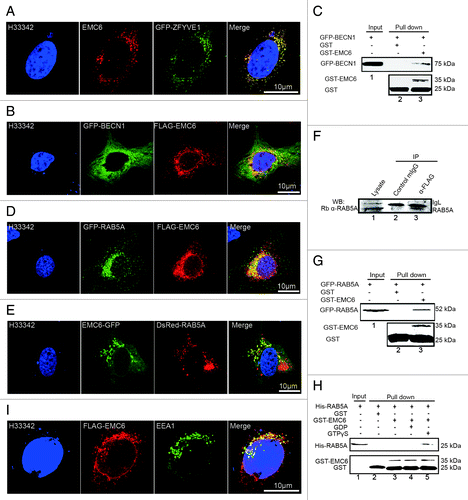 Figure 6. EMC6 is associated with the RAB5A-BECN1 complex. (A, B, D, E and H) Direct or indirect immunofluorescence analysis by confocal microscopy was performed on cells, and nuclei were stained with H33342 as indicated. (A) U2OS cells were cotransfected with EMC6- and GFP-ZFYVE1-expressing plasmids for 24 h and then stained with an anti-EMC6 antibody. (B) U2OS cells were cotransfected with plasmids expressing FLAG-EMC6 and GFP-BECN1 for 24 h and stained with an anti-FLAG antibody. (C) GST-EMC6 fusion protein and the GST protein immobilized on Glutathione-Sepharose beads were incubated with GFP-BECN1-transfected HCT116 cell lysates at 4°C for 4 h. GFP and GST were detected in the washed beads by western blot. (D) U2OS cells were cotransfected with plasmids expressing FLAG-EMC6 and GFP-RAB5A for 24 h and then stained with an anti-FLAG antibody. (E) U2OS cells were cotransfected with plasmids expressing EMC6-GFP and DsRed-RAB5A for 24 h. (F) HCT116 cells were transfected with a plasmid expressing FLAG-EMC6 for 24 h. Total cell extracts were subjected to IP using either an anti-FLAG or a nonspecific control mIgG, as indicated. RAB5A was detected in the IP proteins by western blot. (G) GST-EMC6 fusion protein and the GST protein immobilized on Glutathione-Sepharose beads were incubated with GFP-RAB5A-transfected HCT116 cell lysates at 4°C for 4 h. GFP and GST were detected in the washed beads by western blot. (H) The GST-EMC6 fusion protein or the GST protein immobilized on Glutathione-Sepharose beads were incubated with His-RAB5A or His-RAB5A loaded with GDP or GTPγS. His-RAB5A and GST were detected in the washed beads by western blot. (I) U2OS cells were transfected with FLAG-EMC6 for 24 h and then stained with anti-EMC6 or anti-EEA1 antibody.