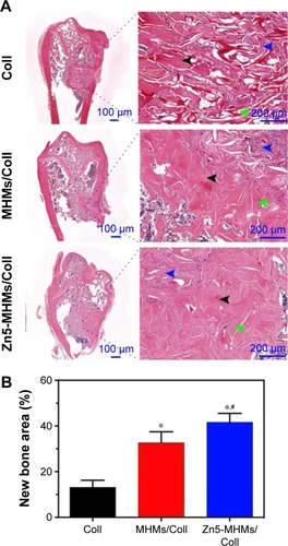 Figure 8 Histological evaluation of bone regeneration in each group. (A) HE staining for newly formed bone (black arrowhead), connective tissue (blue arrowhead), and scaffold remnants (green arrowhead). (B) The percentage of the new bone area assessed by histomorphometric analysis. *P<0.05 compared to Coll group; #P<0.05 compared to MHMs/Coll group.Abbreviations: MHMs/Coll, mesoporous hydroxyapatite microspheres/collagen scaffold; HE, hematoxylin and eosin.