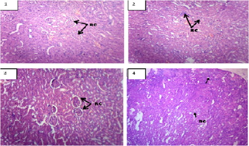 Figure 2. Figure of the brain (Hematoxylin and eosin. H and E × 100). (1) Control group, shows normal neurons (N), (2) 50 mg/kg, (3) 100 mg/kg, and (4) 200 mg/kg of ethanol stem extract of Pterocarpus santalinus.