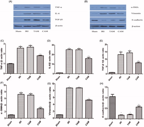 Figure 3. Effects of metformin on TNF-α, IL-6, TGF-β1, α-SMA, Vimentin, and E-cadherin expressions in the kidney after 45 min of ischemia followed by 12 weeks of reperfusion. (A) Representative Western blots showing the effects of metformin on TNF-α, IL-6, and TGF-β1, (B) representative Western blots showing the effects of metformin on α-SMA, Vimentin, and E-cadherin. (C) Relative band densities of TNF-α to the mean value of the control, (D) relative band densities of IL-6 to the mean value of the control, (E) relative band densities of TGF-β1 to the mean value of the control, (F) relative band densities of α-SMA to the mean value of the control, (G) relative band densities of Vimentin to the mean value of the control, (H) relative band densities of E-cadherin to the mean value of the control (*p < 0.05 versus the sham group, #p < 0.05 versus the IRI group. n = 5).