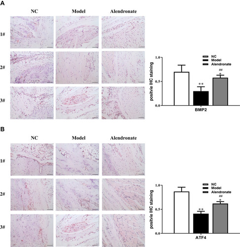 Figure 4 The expression of BMP2 (A) and ATF4 (B) in osteonecrosis and normal tissues detected by IHC. Bar=50 μm. *p<0.05, **p<0.01 compared with the NC group, ##p<0.01 compared with the Model group.