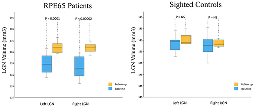 Figure 2 Box Whisker plots of the left and right LGNs for 10 RPE65 patients and 11 sighted controls (8/11 returned for one year follow up). Comparison of the center, spread of group and the median for the left and right LGN volumes shows a significant increase in LGN volume for the left (p<0.0001) and right (p<0.00002) among the RPE65 patients one year after their bilateral retinal gene therapy. Comparison of the left and right LGN volumes from baseline and one-year measurements in sighted controls showed no significant changes in the LGN volume over time.