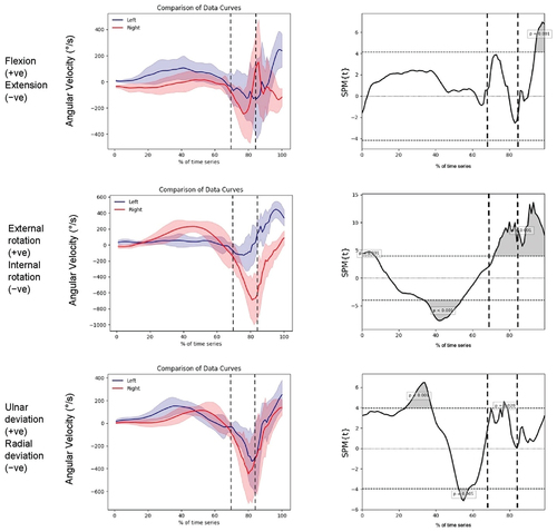 Figure 3. Tri-planar IMU kinematic data for the pitching wedge with corresponding statistical parametric analysis “Swing Onset” occurs at 0, the first vertical dotted line indicates the “Top of Swing” event, the second vertical dotted line indicates the “Impact” event and“ Swing End” occurs at 100.