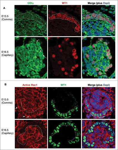 Figure 10. GDIα protein expression increases during kidney development, whereas Rac1 activity decreases. (A) Mouse embryonic kidney sections underwent immunofluorescent analysis with anti-GDIα antibody, WT1 antibody and Dapi. Dotted lines surround podocyte precursors in E13.5 pictures. Arrows show the positive staining for GDIα protein. GDIα protein expression in podocytes was higher at E16.5 than E13.5 (60x magnification). (B) Mouse embryonic kidneys were stained with an anti-WT1 antibody and an antibody that recognizes the active Rac1. There is less active Rac1 at E16.5 than at E13.5. Dotted lines mark the border between podocytes and developing capillaries. Arrows indicate areas of high Rac1 activity at E13.5.