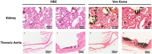 Figure 7. Representative histopathological images in thoracic aorta and renal tissues from the A4 + AP12 group. The continuous renal tissue slices were stained with H&E (A, B) and von Kossa (C, D). calcified depositions were observed in the glomerular basement membrane (grey arrowhead) and tubular basement membrane (yellow arrowhead). Representative images of moderate aorta calcification were stained with H&E (E, F) and von Kossa (G, H).