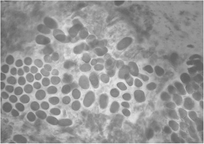 Figure 4 Microscopic observation of analysed Bromus seed without endophyte. Magnification: 400×.