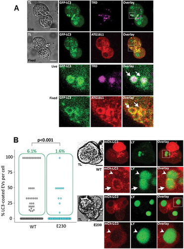 Figure 7. LC3-coating of endocytic vacuoles involves ATG16L1 and is suppressed in pancreatic acinar cells from Atg16L1E230 mice. (A) Correlative images of GFP-LC3 fluorescence in live cells and immunofluorescence labeling of ATG16L1 in fixed cells. TL indicates transmitted light images. Scale bars: 10 µm. In these experiments GFP-LC3 (green) PACs were stimulated with 500 pM CCK for 30 min in the presence of TRD (magenta to identify EVs) and imaged live on gridded dishes. They were then fixed with 4% PFA. Immunofluorescence staining for ATG16L1 (red) was performed as described in the Materials and Methods section. Correlative images of the same cells are shown: live cells (first [upper] row of images) and fixed cells (second row of images). Cellular region containing 2 LC3-coated EVs is highlighted by dashed boxes on the Overlay images of live and fixed cells; this region is shown on the expanded scale in the 2 bottom rows. White arrows point toward the LC3-coated EVs. Note colocalization of GFP-LC3 fluorescence with immunostaining for ATG16L1 on these organelles. In these experiments we analyzed 47 EVs and co-localization between GFP-LC3 and ATG16L1 immunostaining was observed in 45 of those EVs. Further description of correlative imaging of PACs before and after fixation is given in Supplementary material (see Fig. S10). (B) The dot plot shows the percentage of LC3-coated EVs formed in mCherry-LC3A expressing PACs (see images in the right panels), stimulated with 100 pM CCK for 30 min in the presence of Lucifer Yellow (LY). Each dot represents one cell and gives a percentage of LC3-coated EVs in this cell. The green boxes highlight cells with percentage of LC3-coated EVs above 0; the percentage of such cells is indicated above the boxes (green number). The rows of dots below the green boxes indicate cells which did not have LC3-coated EVs. The left part summarizes results of experiments with PACs from WT mice (N = 9 mice, nC = 577 cells, nV = 1416 EVs of which 35 were LC3-coated [2.5%]) and the right part illustrates outcome of experiments with PACs from Atg16L1E230 mice (abbreviated E230 on the figure; N = 11 mice, nC = 668 cells, nV = 1665 EVs of which 12 were LC3-coated [0.7%]). Images in the right panels illustrate EVs in PACs expressing mCherry-LC3A (mCh-LC3; red). Replication-deficient adenovirus was utilized to express mCh-LC3 in these PACs. The lower set of images was recorded from PACs derived from Atg16L1E230 mice (abbreviated as E230 in the figure); the upper set of images was recorded from PACs derived from WT mice. The cells were stimulated by 100 pM of CCK in the presence of LY; LY fluorescence is shown in green. TL indicates transmitted light image. Scale bars: 10 µm. The dashed boxes in the right (overlay) panels highlight the fragments, shown on the expanded scale below the complete images. The arrow on the WT fragment indicates an LC3-coated EV. Arrowheads on the WT and E230 fragments indicate EVs which were not coated by LC3. Only very few EVs in E230 cells were coated with mCherry-LC3 (0.7% of EVs; see the dot plot and accompanying text above); therefore, cells containing uncoated EVs (all 3 EVs in the E230 PACs shown in the figure are uncoated) were selected as representative for E230 cells. An example of an uncoated EV is also shown at an expanded scale (bottom row).