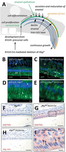 Figure 1. Suppression of autophagy in the enamel epithelium of Atg7f/f Krt14-Cre mice. (A) Schematic depiction of structure and growth of a murine maxillary incisor. Ameloblasts proliferate in the cervical loop and subsequently differentiate to produce enamel, including a superficial iron-rich layer. (B-E) The Gfp-Lc3 transgene was introduced into Atg7f/f (B, D) and Atg7f/f Krt14-Cre (C, E) mice. Upper jaws were sectioned and immuno-labeled with anti-GFP (green). Nuclear DNA was labeled with Hoechst dye (blue). Panels D and E show higher magnifications of the boxed areas in panels B and C, respectively. Arrows in D mark GFP-LC3-positive vesicles. am, ameloblasts; pl, papillary layer. (F-I) Immunostaining of the autophagy substrate SQSTM1. Sections through the enamel organ of Atg7f/f (F) and Atg7f/f Krt14-Cre (G-I) mice were immunostained for SQSTM1 (red). A negative control staining of Atg7f/f Krt14-Cre tissue is shown in panel H. Scale bars: 20 µm (B, C), 5 µm (D, E), 50 µm (F-H), 10 µm (I).