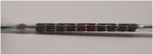 Figure 1. A zinc-stent crimped onto a stent delivery balloon. Circles indicate the radiopaque positioning markers of the ultra-thin strut region. The rectangular bar indicates the area of ultra-thin strut size.The flat bar indicates the radiopaque positioning marker of the distal balloon tip