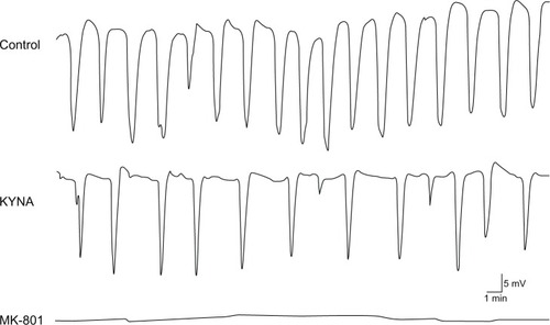 Figure 4 Representative cortical spreading depression (CSD) waves recorded in the barrel cortex.