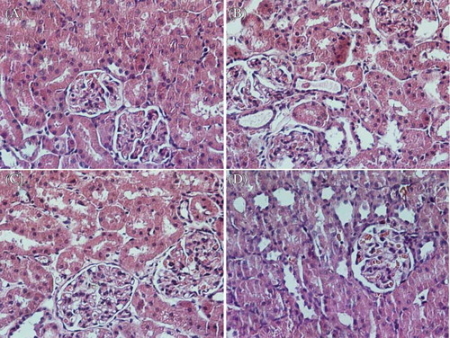 Figure 3.  Haematoxylin and eosin stained sections of rat kidneys. (A) Normal kidney section. (B) Kidney section of a glycerol-treated rat showing severe tubular necrosis and cast formation. (C) Kidney section of a L-citrulline (900 mg/kg) + glycerol treated rat showing moderate necrosis and cast formation. (D) Kidney section of a dexamethasone + glycerol treated rat showing moderate necrosis and cast formation.
