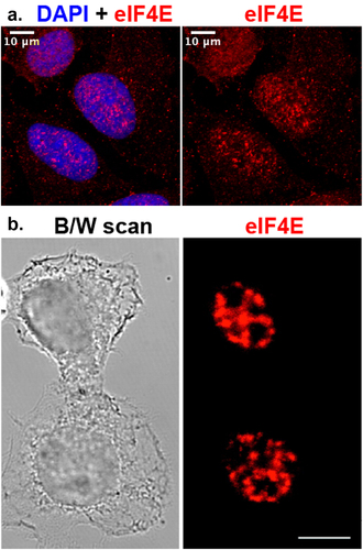 Figure 1. A, Single section of confocal imaging of U2OS cells stained for eIF4E (sc-271480 anti-eIF4E antibody, red) and DAPI (blue, nuclear dye) showing nuclear and cytoplasmic localization. Left panel shows the overlap between DAPI and eIF4E staining. The right panel shows eIF4E signal alone. B, Confocal imaging of eIF4E in the nucleus of HeLa cells with the antibody 10C6 from [Citation101]. Reprint with permission from Dostie J, Lejbkowicz F, Sonenberg N. Nuclear eukaryotic initiation factor 4E (eIF4E) colocalizes with splicing factors in speckles [Citation99]. White bar = 10μm.