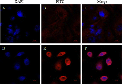 Fig. 6. Detection of cell transfection and immunofluorescence microscopy assay DAPI: “javascript:void(0);” blue fluorescence; FITC: “javascript:void(0);” red fluorescence; Merge: superimposed image of the blue fluorescence and “javascript:void(0);” red fluorescence. (A), (B) and (C) The pVAX1 plasmid was transfected into the cells. (D), (E) and (F) The pVAX1-pRAG2 recombinant plasmid was transfected into the cells.