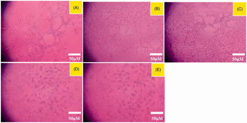 Figure 5. Destructive effects on VM channels after treatments with the varying formulations. a. blank micelles; b. paclitaxel micelles; c. DQA modified paclitaxel micelles; d. paclitaxel plus honokiol micelles; e. DQA modified paclitaxel plus honokiol micelles.